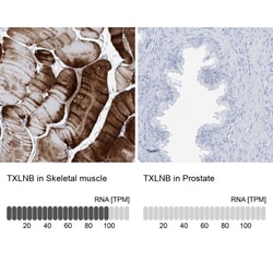 TXLNB Antibody, Novus Biologicals 0.1mL; Unlabeled:Antibodies, Polyclonal